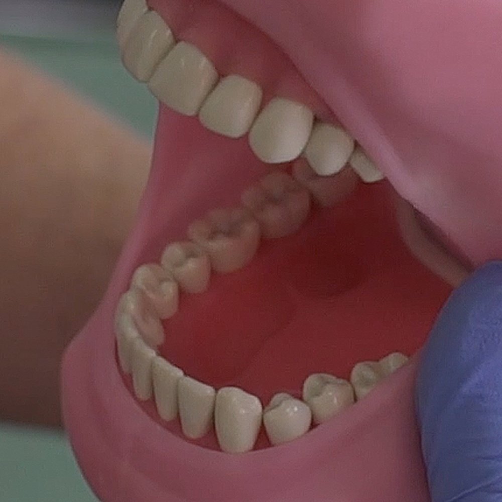 Plain Teeth